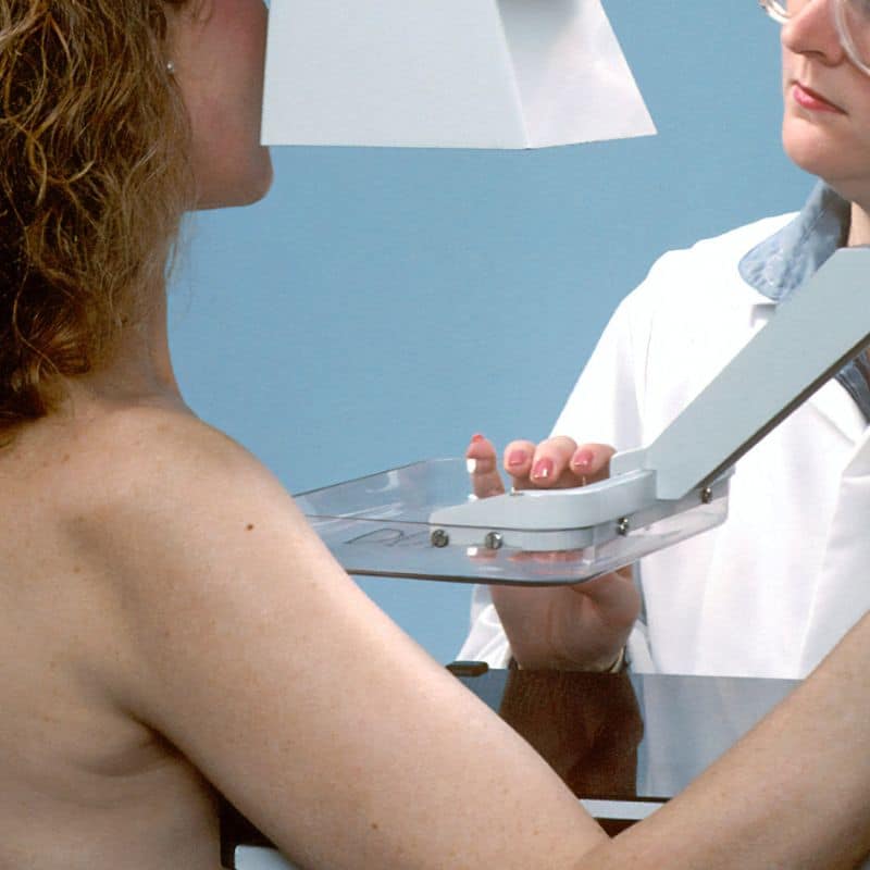 Procedimiento de la mamografía.