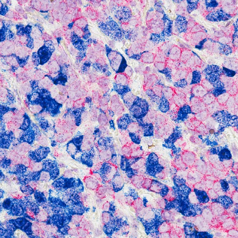 Estudio genético para la detección de predisposición a tener cáncer.