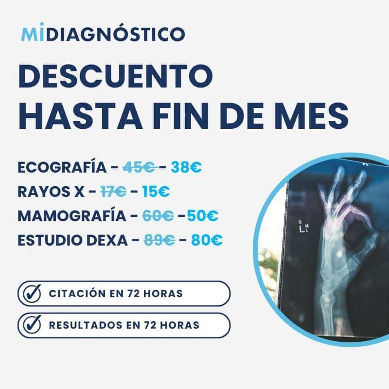 descuento-exclusivo-md-fin-mes
