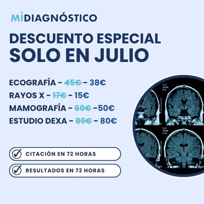 promoción Mi Diagnóstico Julio