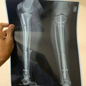 Radiografía en Zaragoza para niños y adultos, al mejor precio.