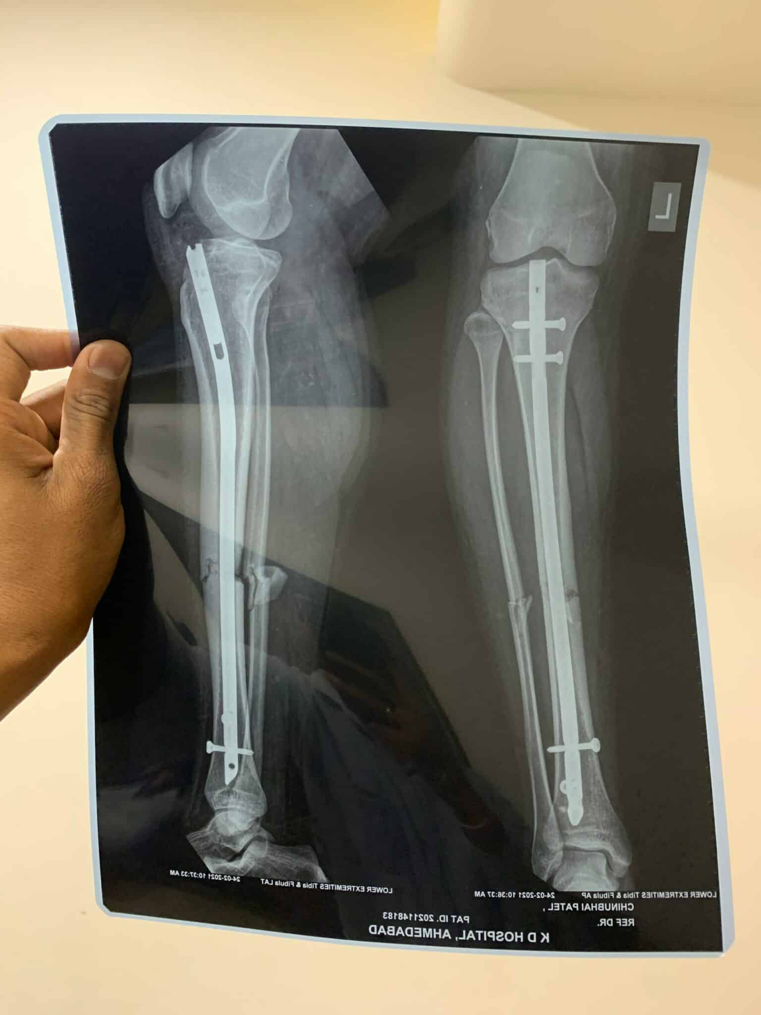 Radiografía en Zaragoza para niños y adultos, al mejor precio.