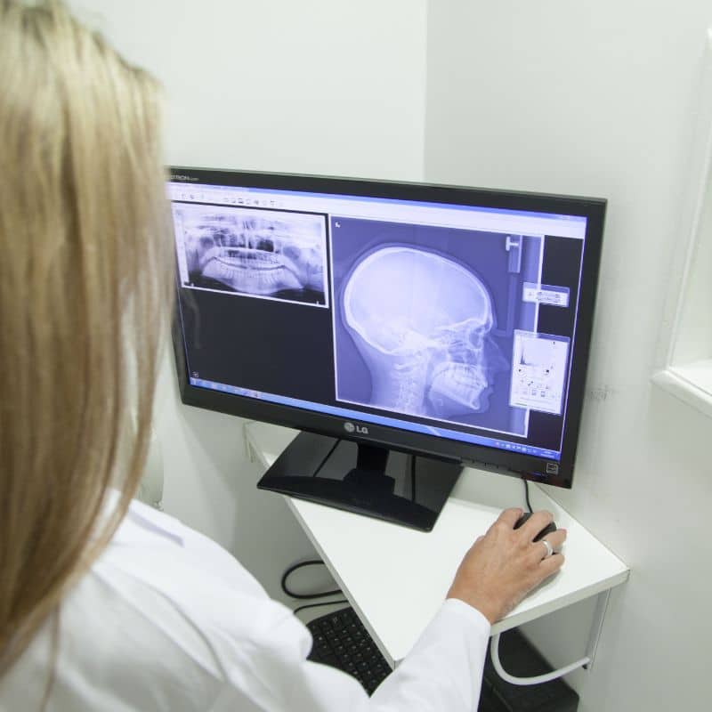 La resonancia magnética de la articulación temporomandibular (ATM) es esencial para la detección de múltiples enfermedades y trastornos.