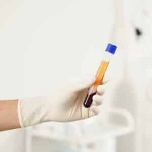 Servicio de plasma rico en plaquetas (PRP), en VIVO SAGASTA.