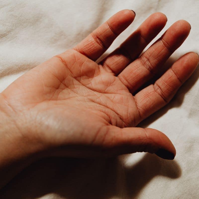 Ecografía de Mano-Dedos