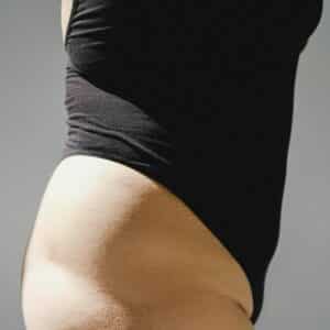 Resonancia magnética de cadera en MIDIAGNOSTICO, al mejor precio.