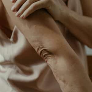 Comprar resonancia magnética de codo, en MIDIAGNOSTICO.