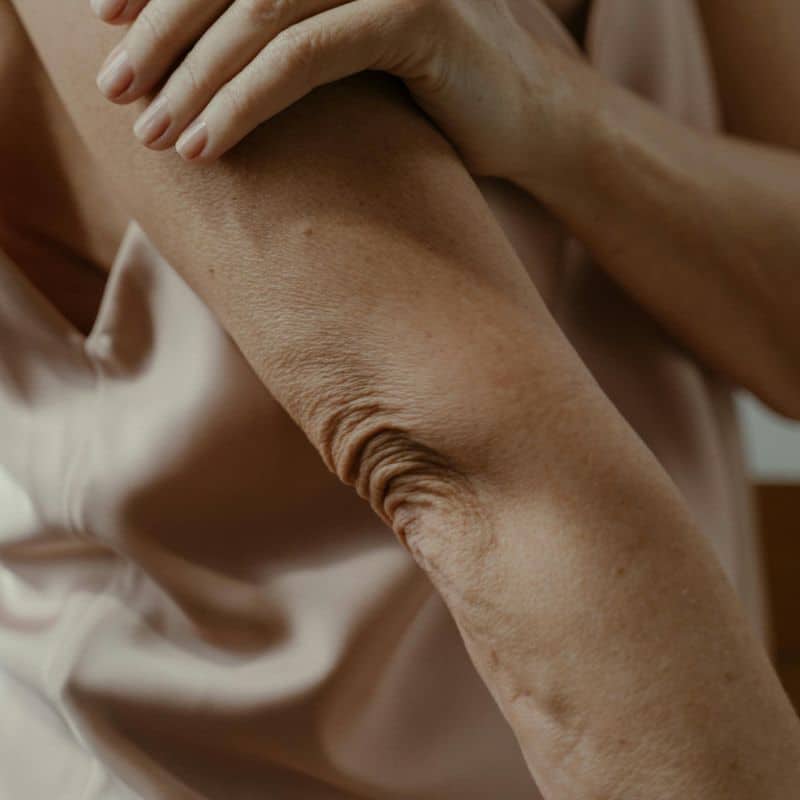 Resonancia Magnética de Codo