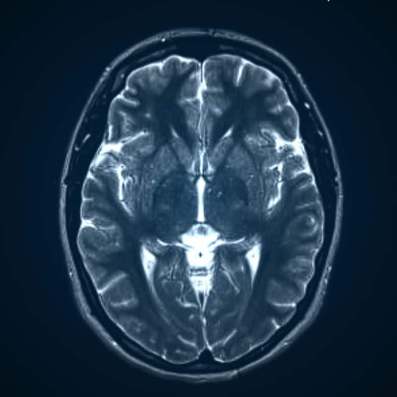 Prevención y seguimiento con tu resonancia magnética en Madrid, al mejor precio.