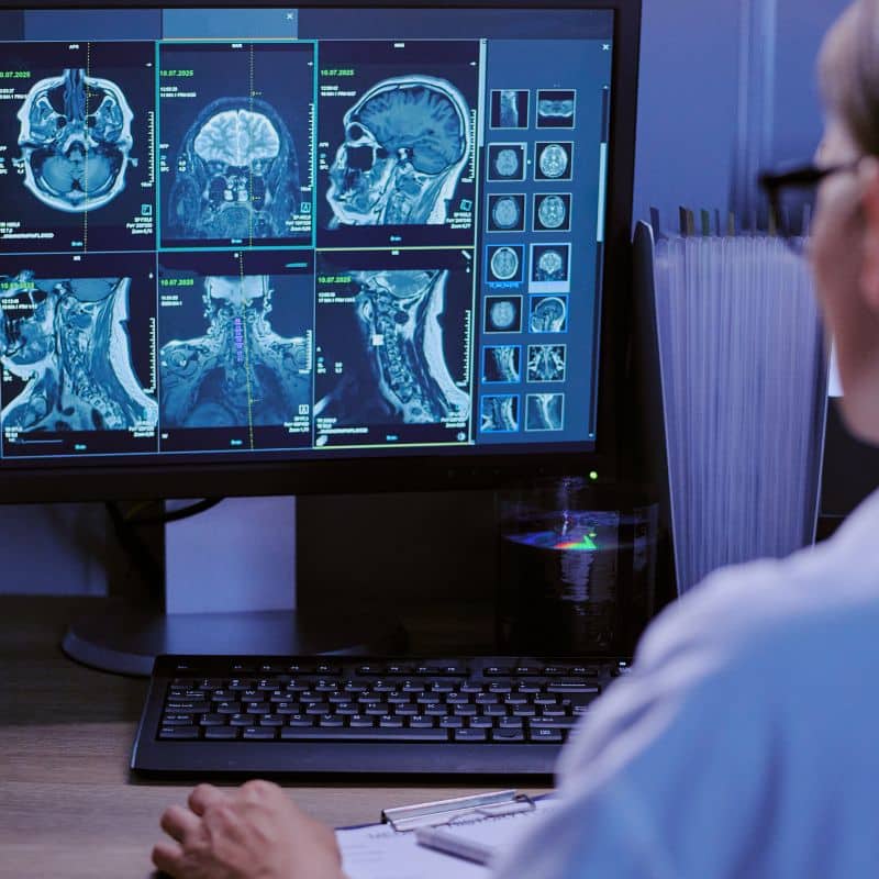 Resonancia magnética privada en MIDIAGNOSTICO, al mejor precio.