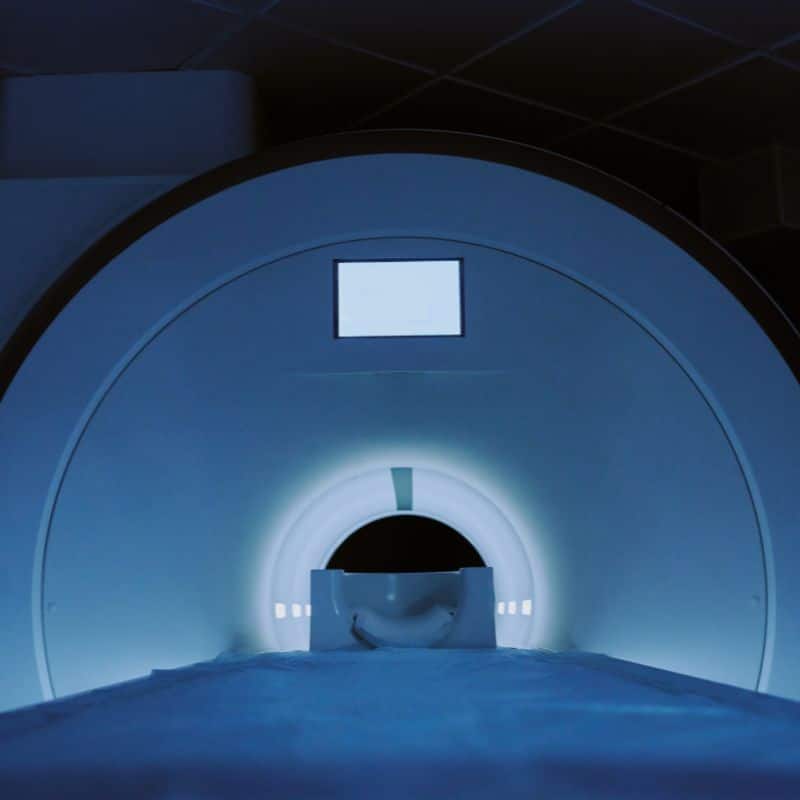 Resonancia magnética privada en Madrid, al mejor precio.