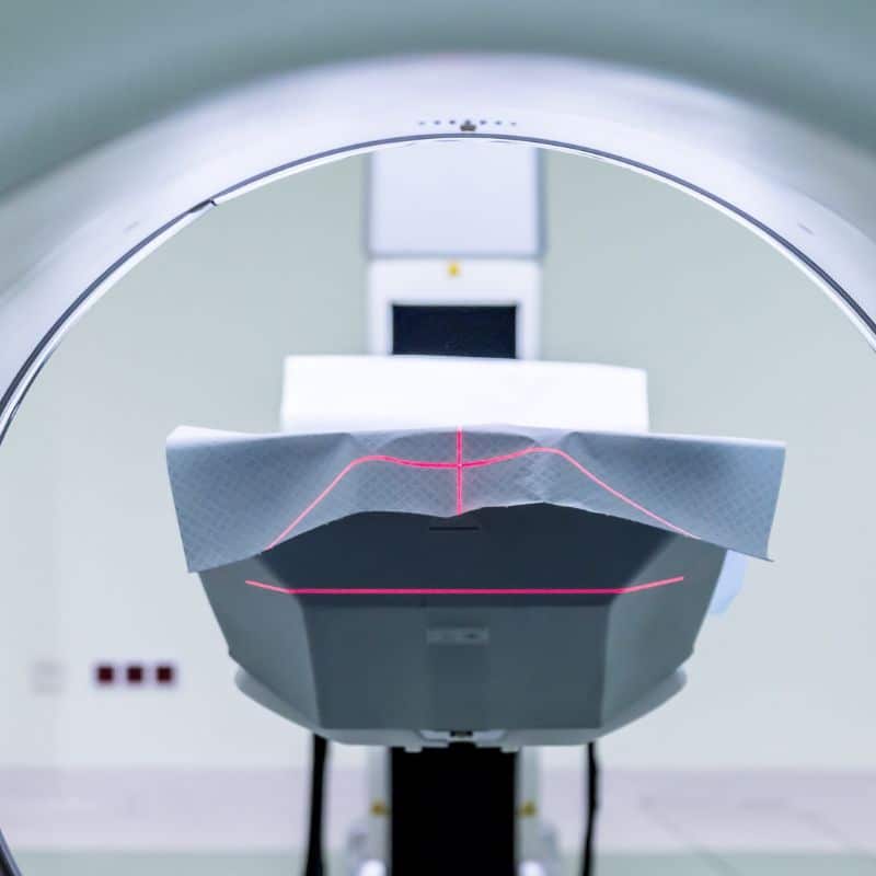 Resonancia magnética particular: ¿cuál es la mejor opción?