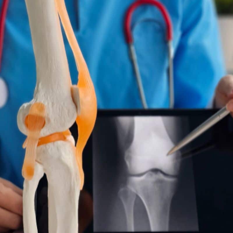 Resonancia de rodilla barata, en Madrid.
