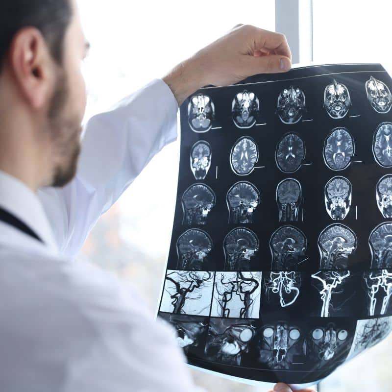 Resonancia abierta, sin necesidad de prescripción médica.