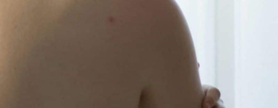 Ecografía de partes blandas, comprar en MIDIAGNOSTICO.