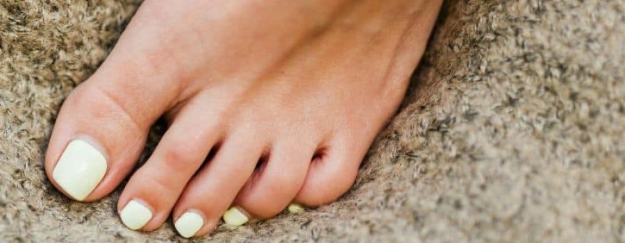 Comprar ecografía de pie en MIDIAGNOSTICO.