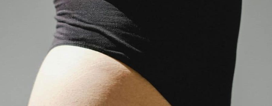 Resonancia magnética de cadera en MIDIAGNOSTICO, al mejor precio.